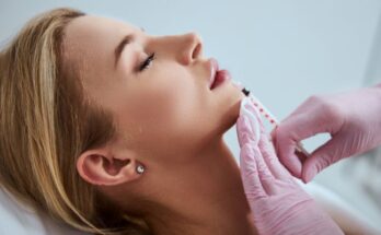 Dermal Filler Injection Timeline: What To Know
